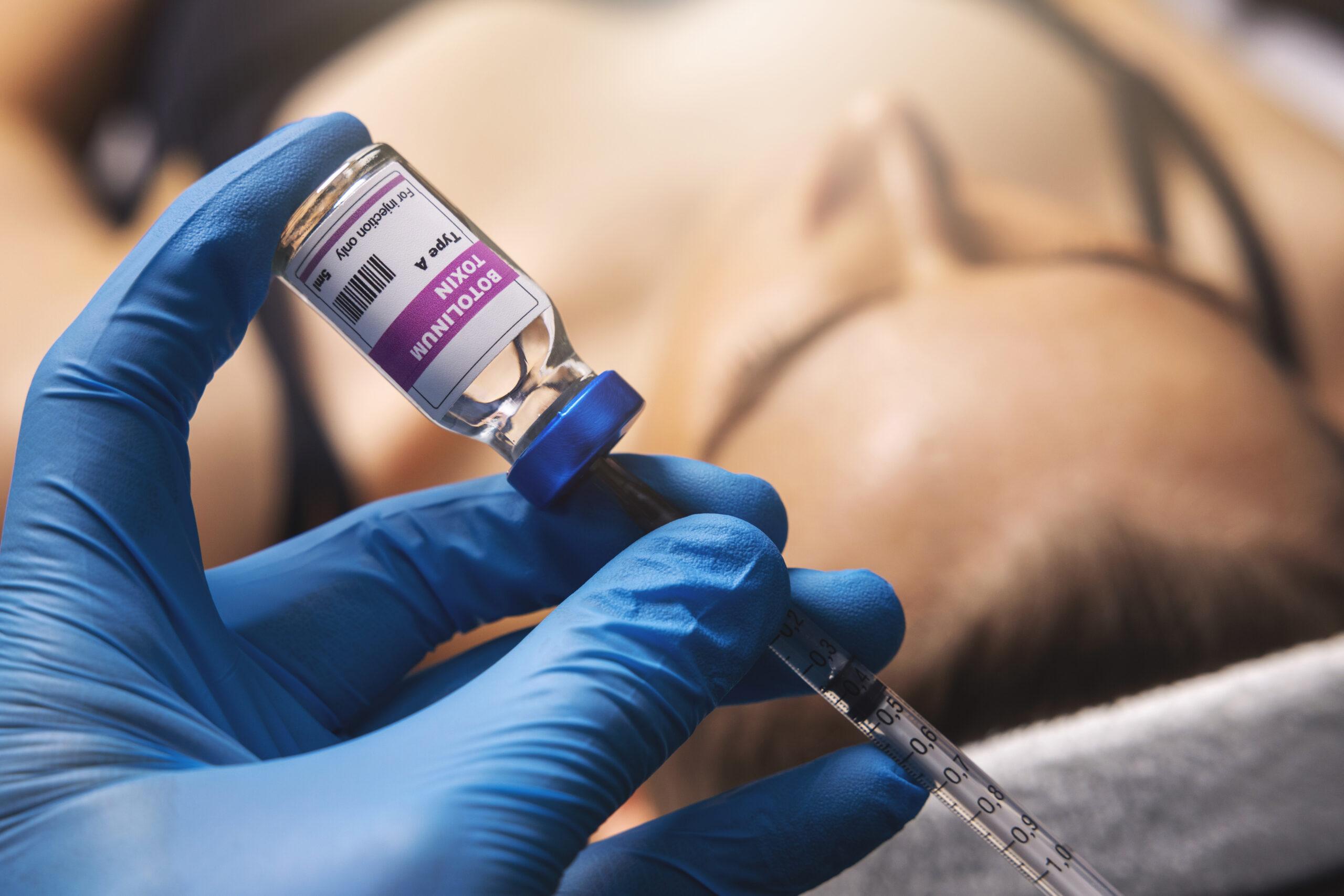 What to do after BOTOX treatment?