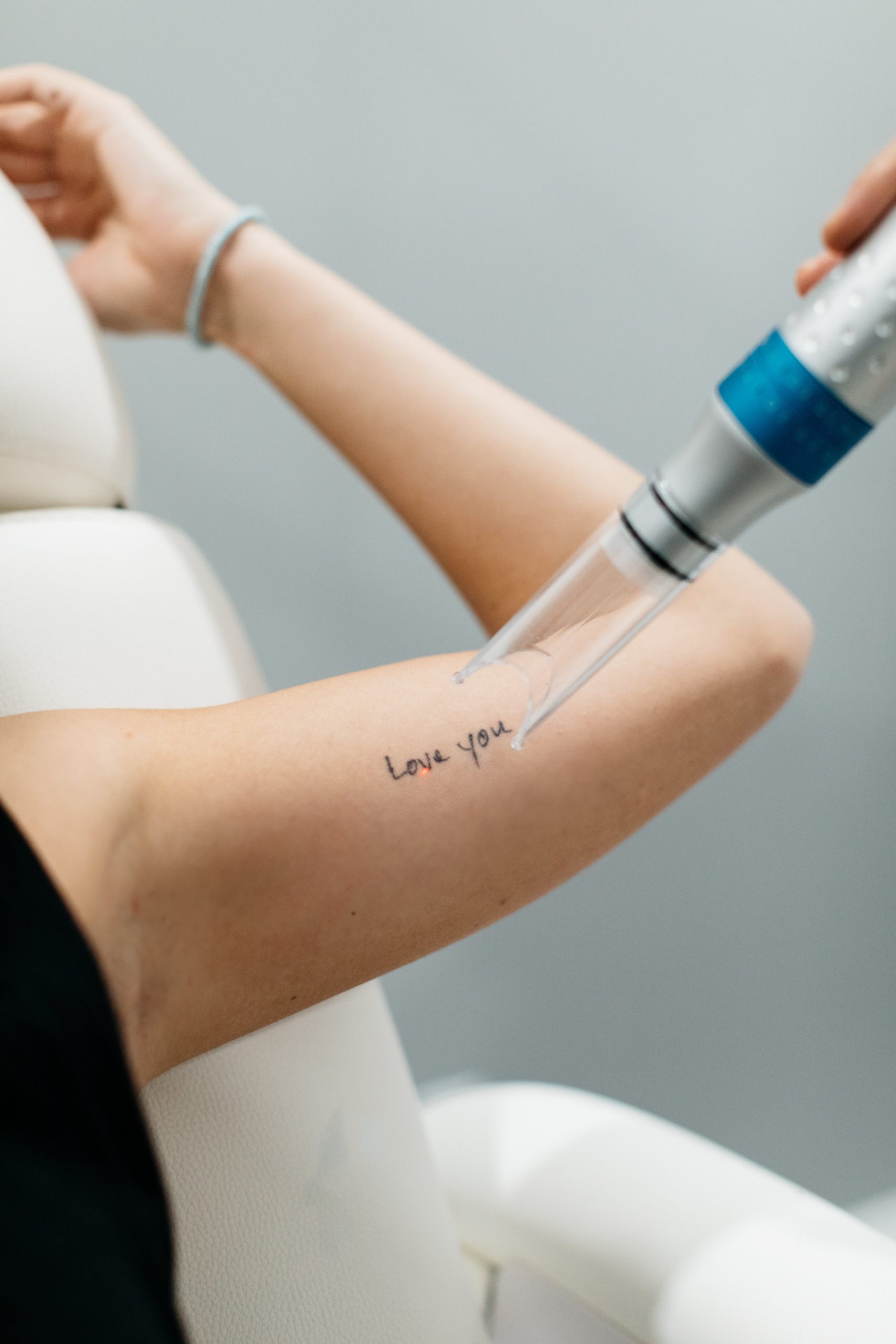 Laser Tattoo Removal in the Bay Area | Essential Aesthetics