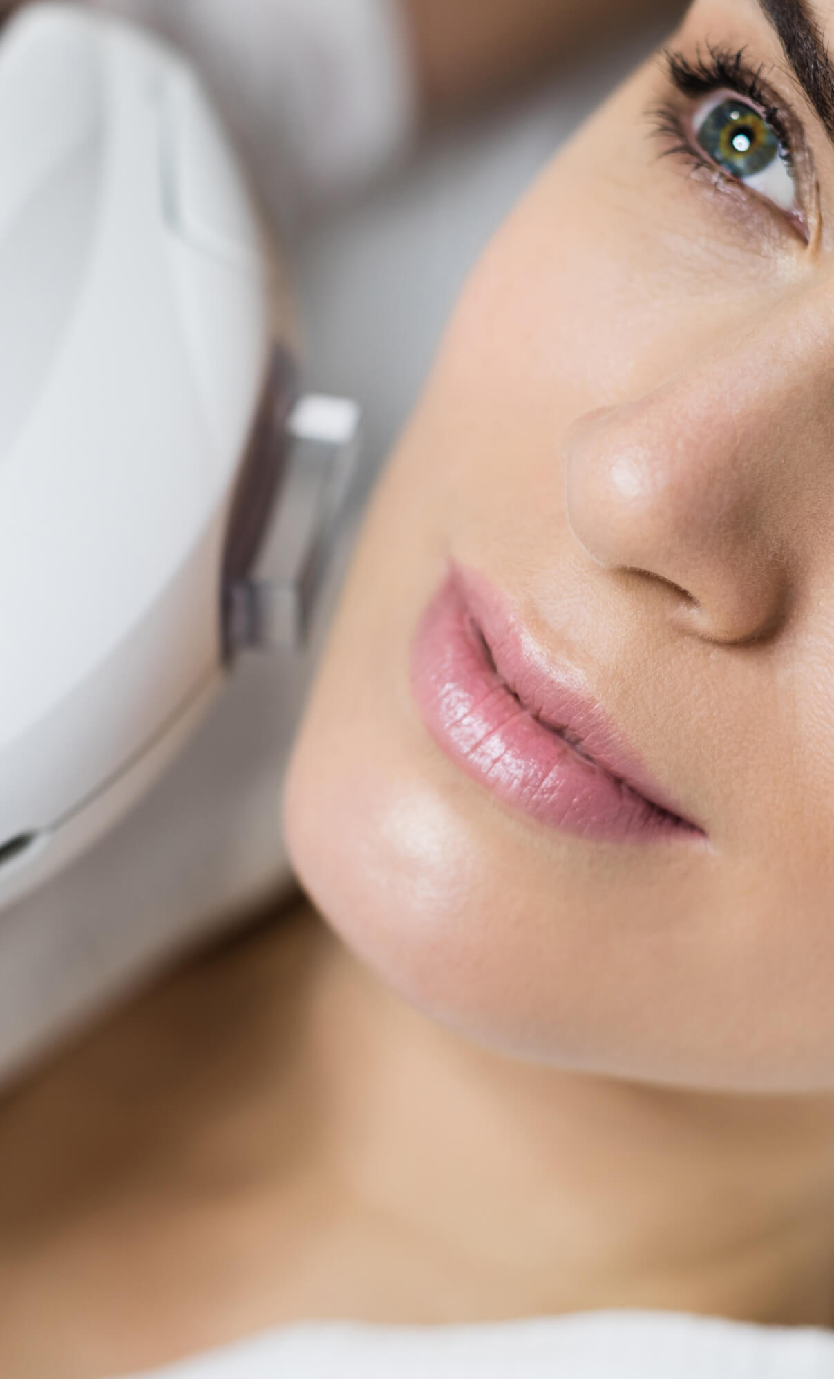 IPL treatments for strecth mark removal at Essential Aesthetics