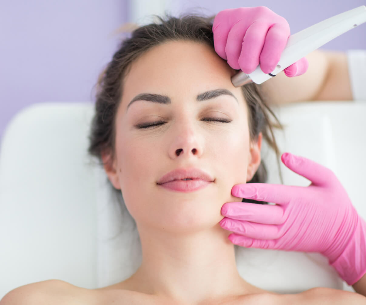 Radiofrequency Microneedling at Essential Aesthetics
