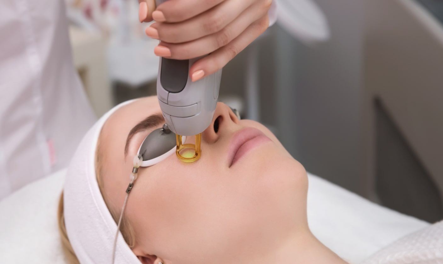 Photoacoustic Fractional Laser