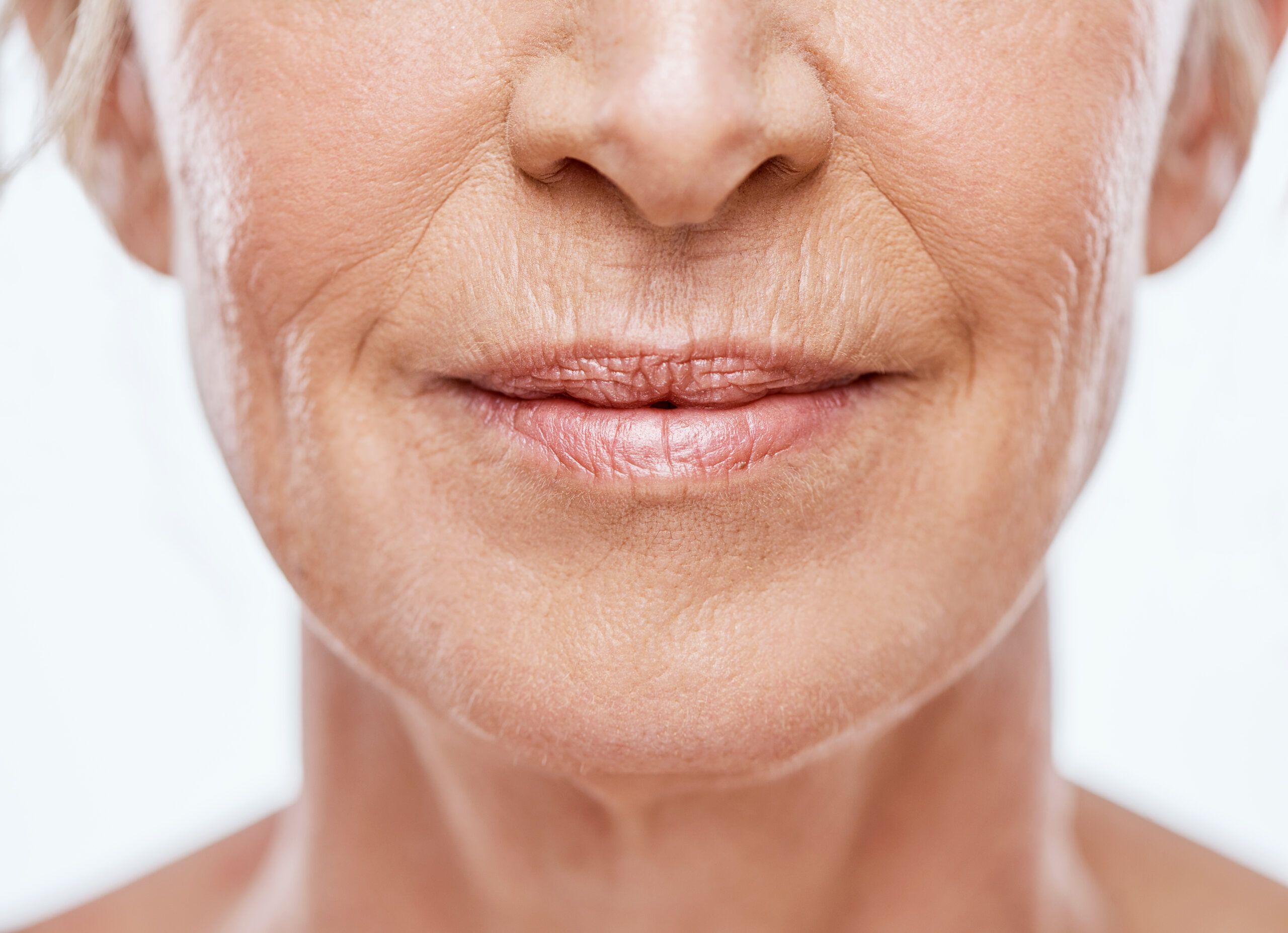 How to get rid of wrinkles without injection?